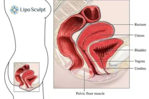 Treatment For A Leaky Bladder 2 How EM Chair treatment Abingdon can help Leaky bladder issues. Read more now!
