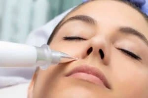 Best Actinic Keratoses Removal 3 Actinic keratoses Abingdon solutions - book in today!