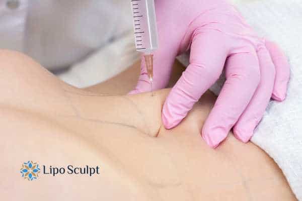 Aqualyx for Muffin Tops: What to Know Before Fat-Dissolving Injections 4 Are there risks Abingdon?