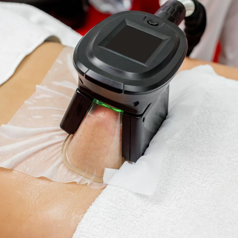 Fat Freezing treatment Abingdon